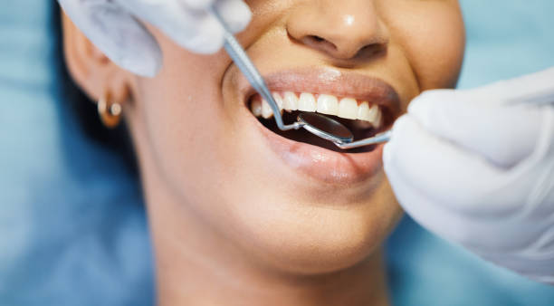 Best Emergency Dentist for Lost Fillings or Crowns in Tyrone, OK